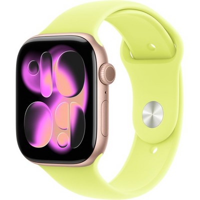 Умные часы Apple Watch Series 11, 46 mm, Rose Gold Aluminium Neon Yellow Sport Band - фото 16561